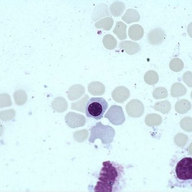 Orthochromatic_erythroblast