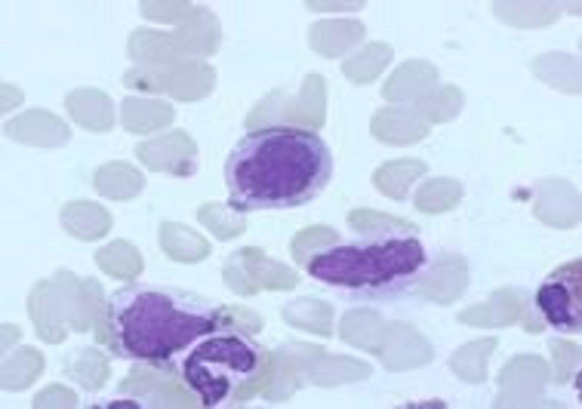 Field from RBC section showing numerous monocytes