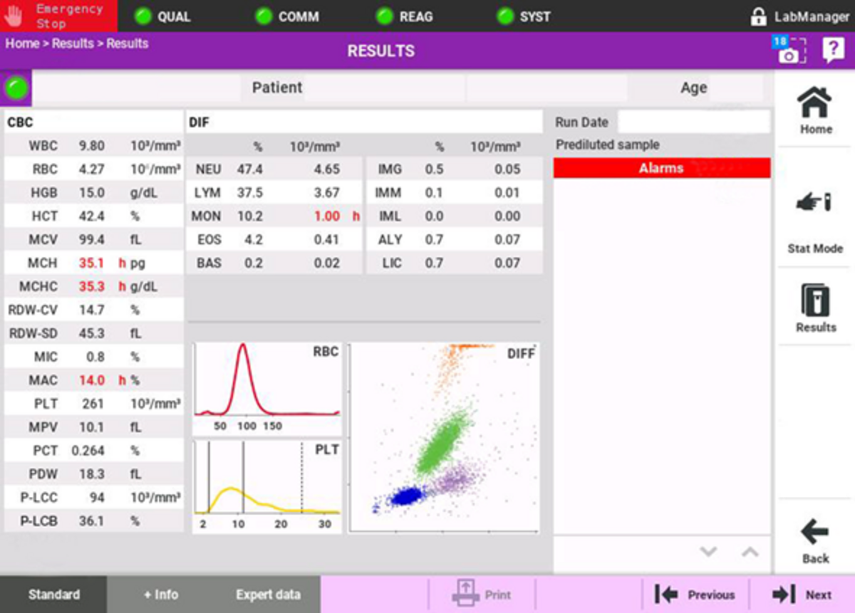 Figure 1: Example showing presentation of results on the Yumizen H500
