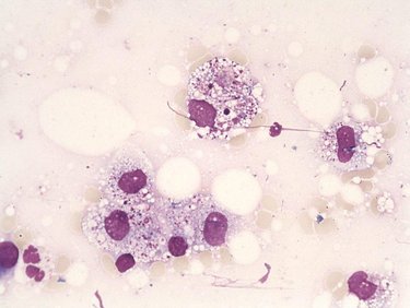 Histiocyte