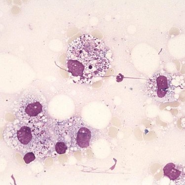 Histiocyte