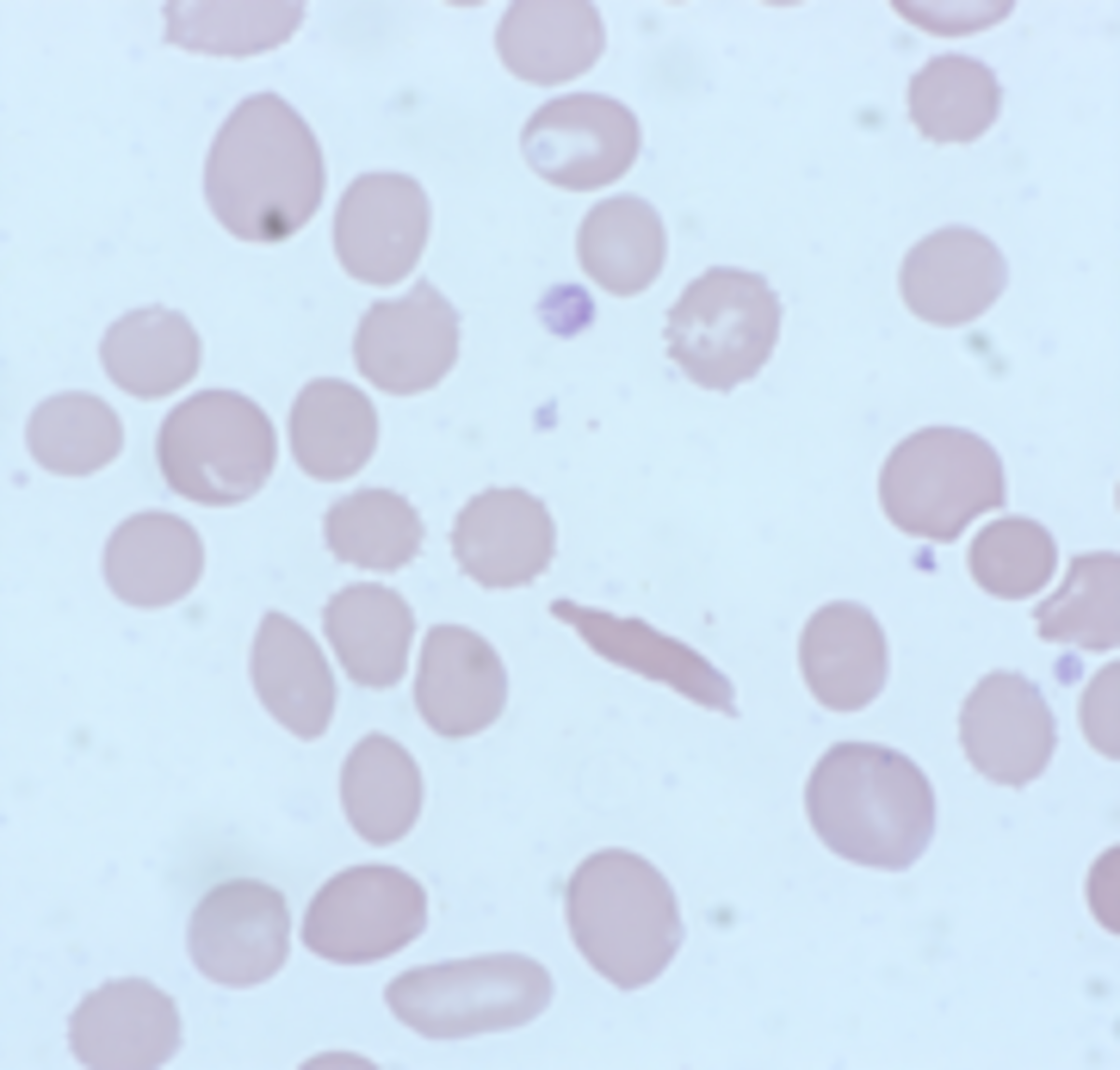 Lab CE Course - Erythrocyte Inclusions Flashcards | Quizlet