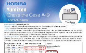 Chronic Lymphocytic Leukemia - Hematology Clinical Case "Chase the Case" #49