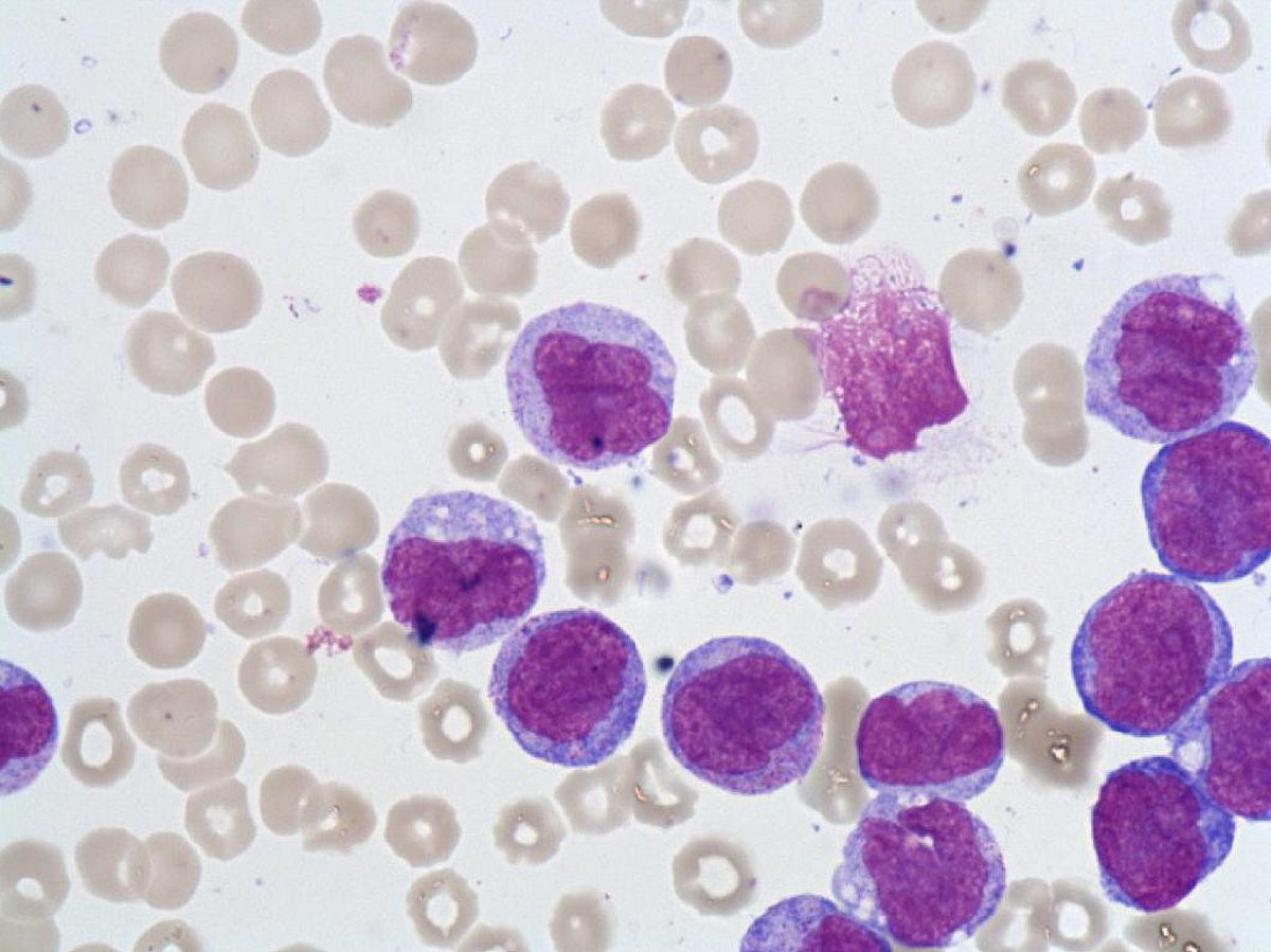 Promonocyte