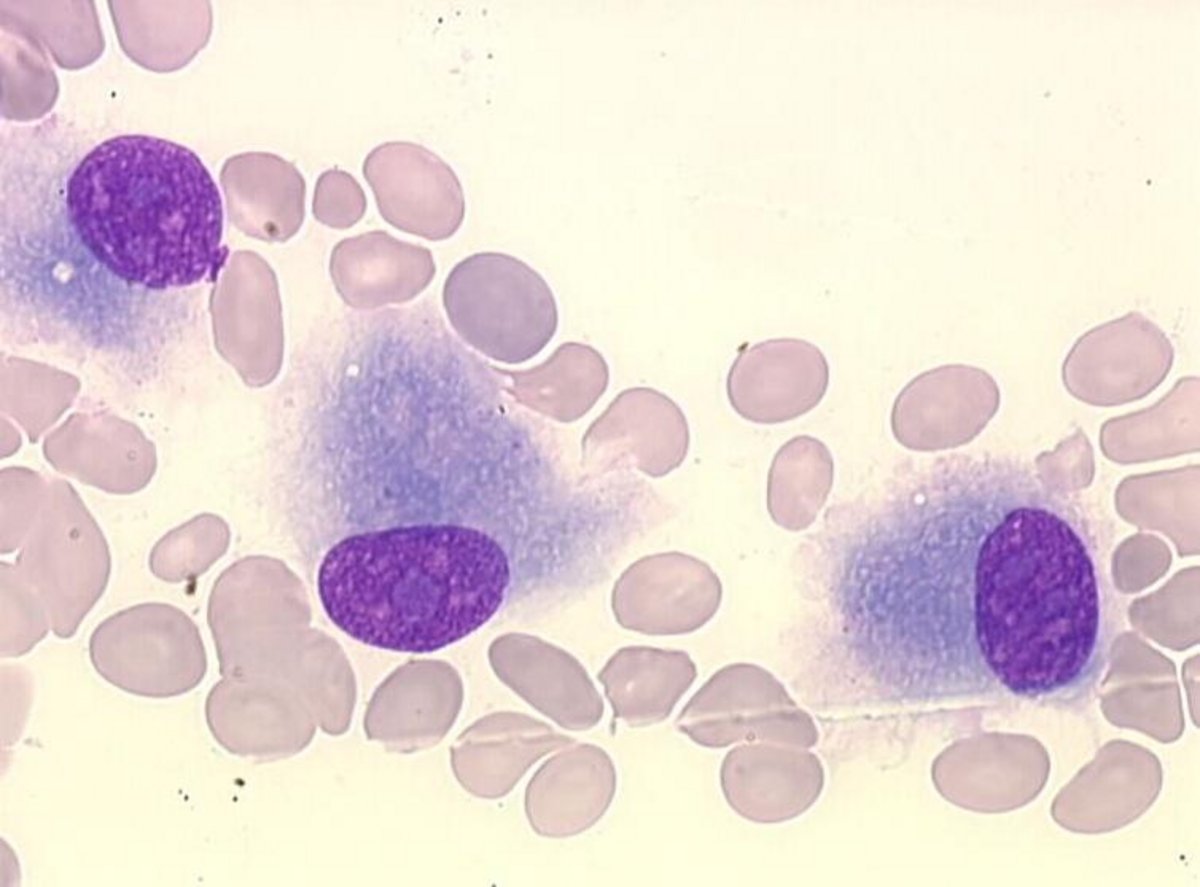 Osteoblast Osteoblast