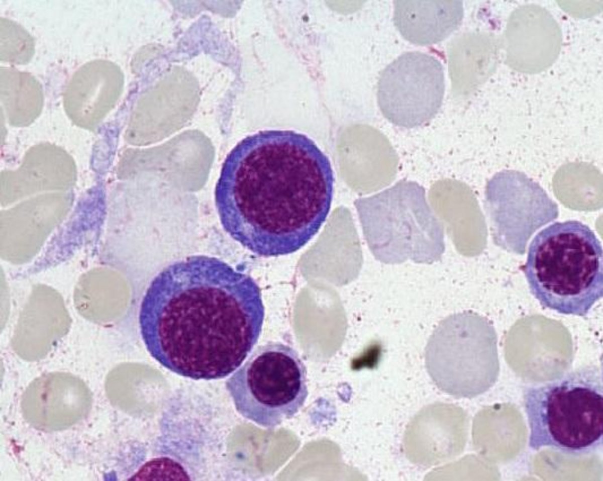  Basophil_erythroblast