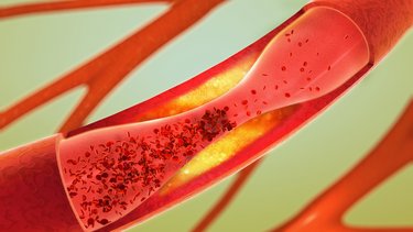 HORIBA hemostasis