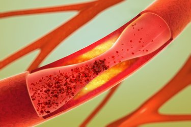 HORIBA hemostasis