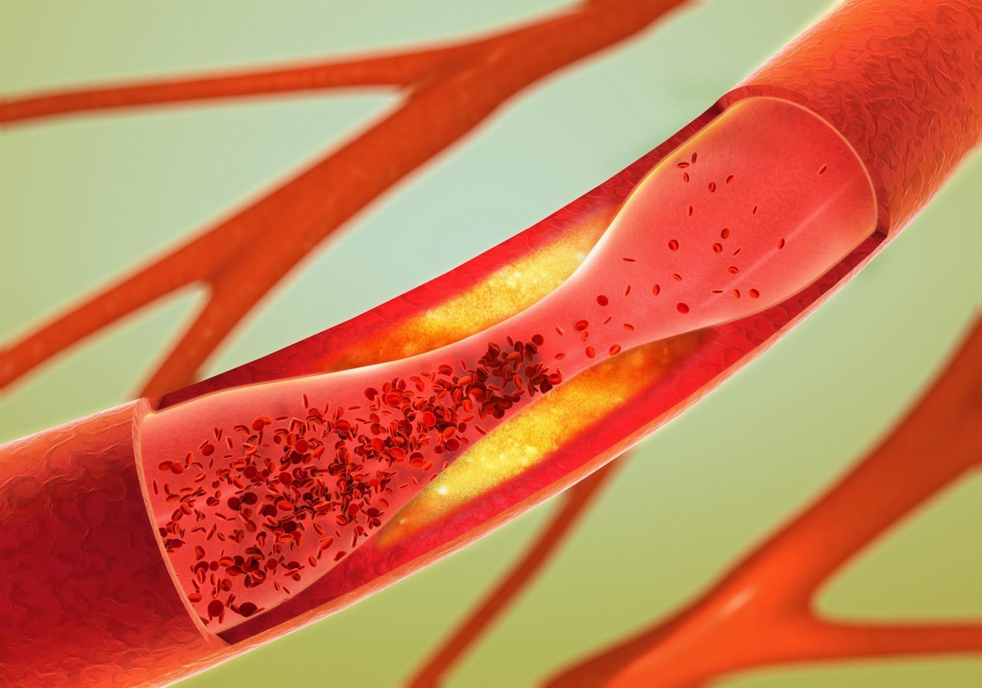 HORIBA hemostasis