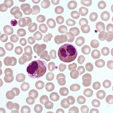 Eosinophil_polymorphonuclear