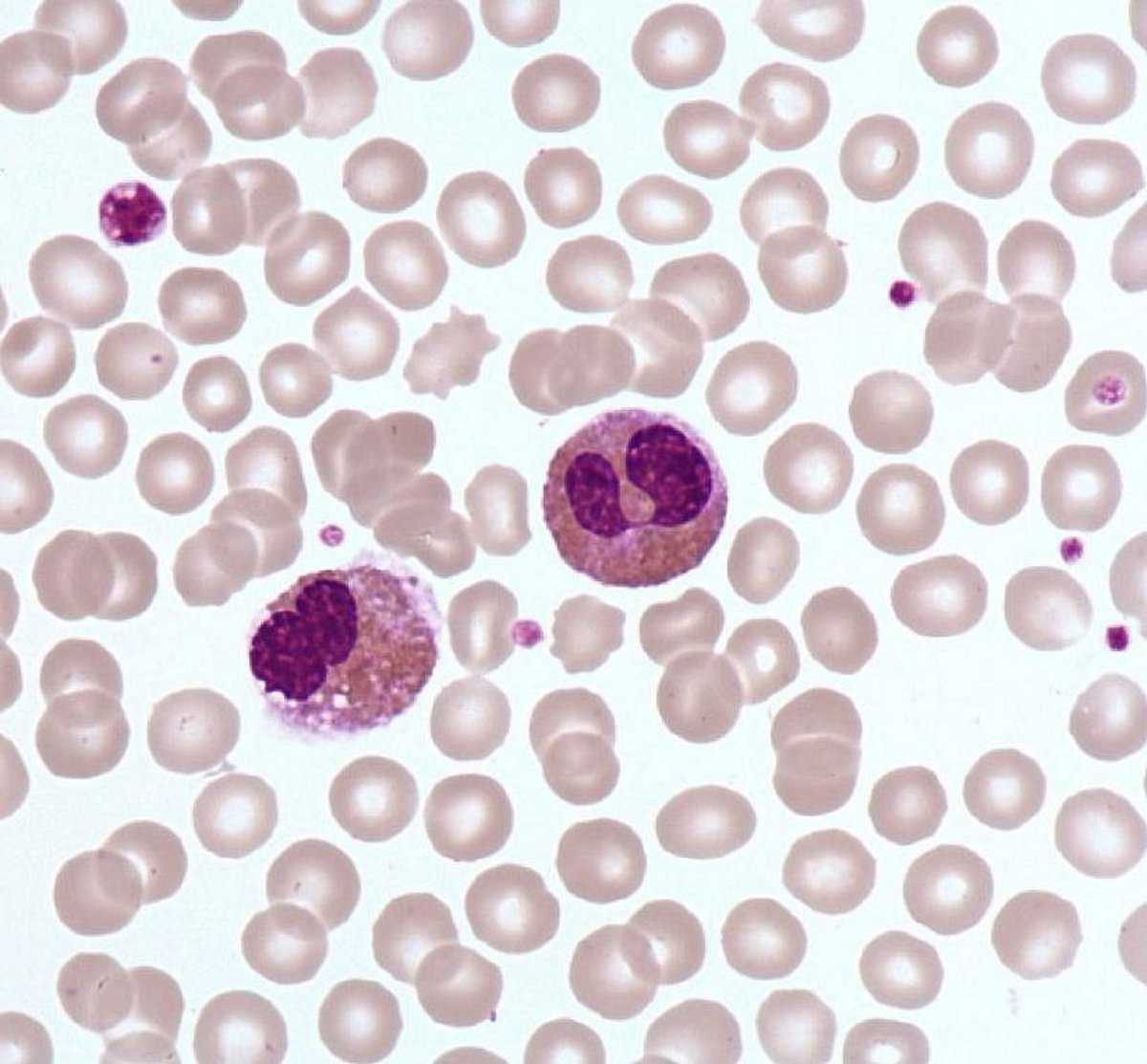 Eosinophil_polymorphonuclear Eosinophil_polymorphonuclear