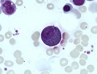 Eosinophil_myelocyte