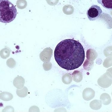 Eosinophil_myelocyte
