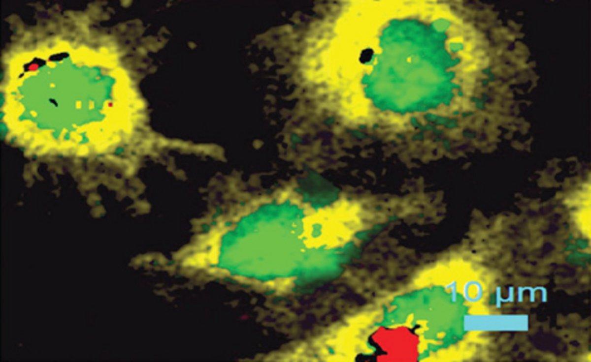 The development of ultra-fast Raman spectral imaging modules allows drastically reduced measurement times with acquisition times down to < 1ms/point.
