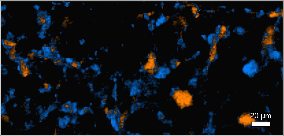 Polymorphisms characterization: when Raman microscopy supports the ...