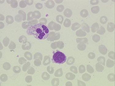 Villous_lymphocyte