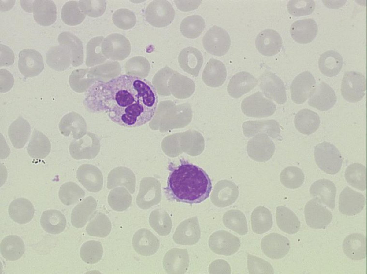 Villous_lymphocyte