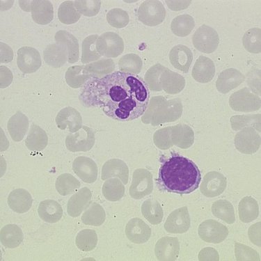 Villous_lymphocyte