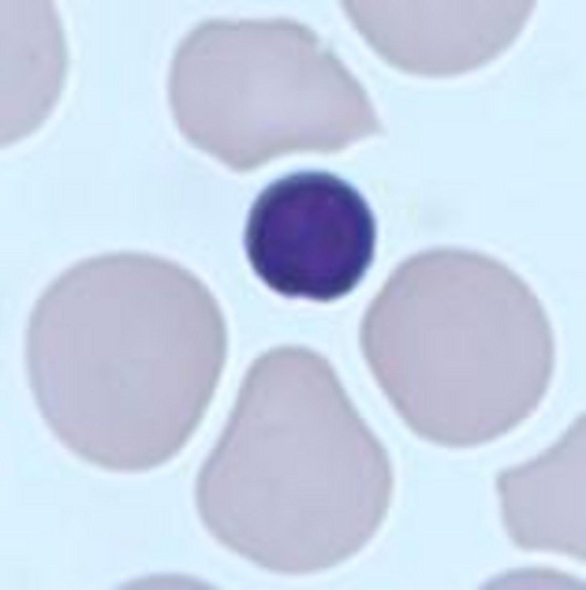 Hemoglobinopathies qsp newsletter 38 horiba medical 