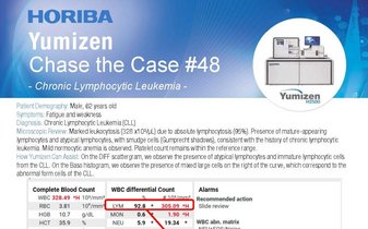 Chronic Lymphocytic Leukemia - Hematology Clinical Case "Chase the Case" #48