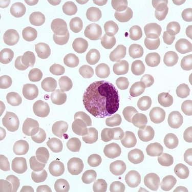 Eosinophil_metamyelocyte
