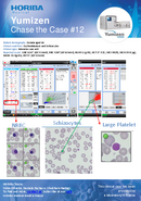 HORIBA Medical Chase the Case #12 - Erythroblastosis and Schizocytes thumbnail