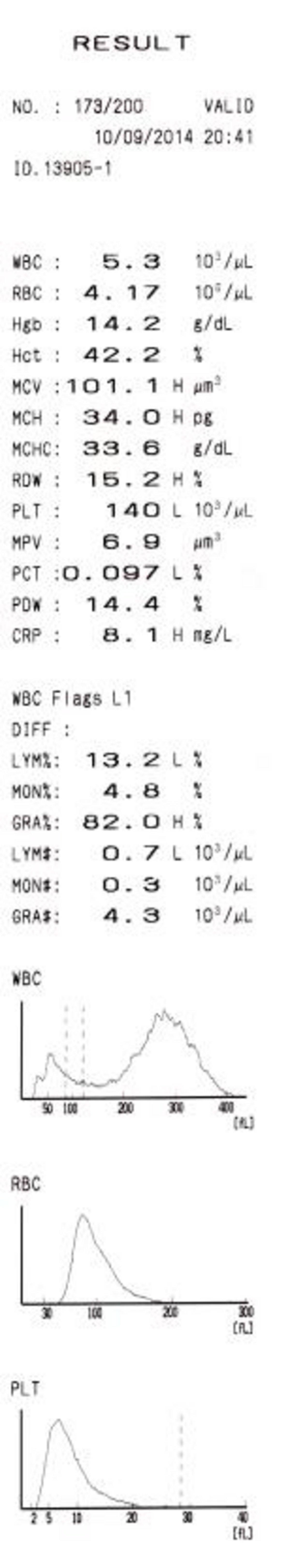 Examples of pathological cases-right