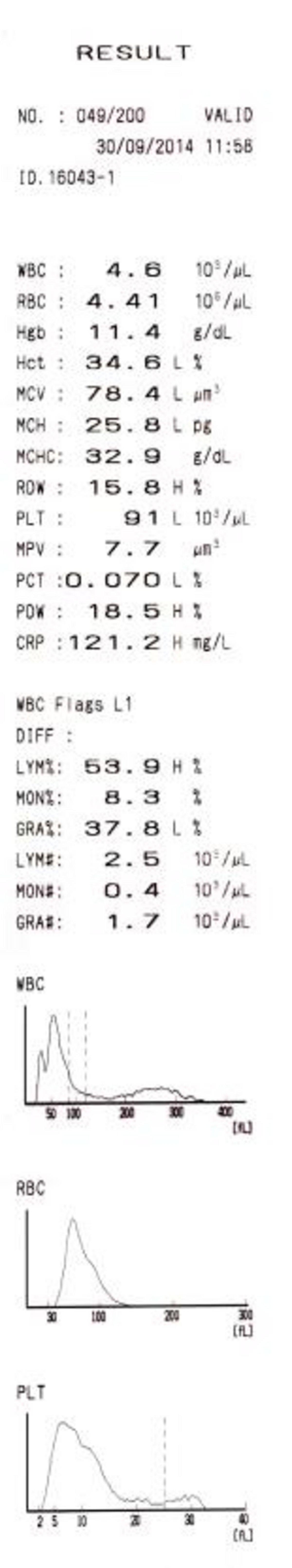 Examples of pathological cases-center