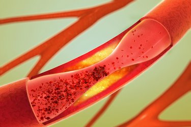 Hemostasis