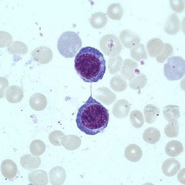 Polychromatophilic_erythroblast