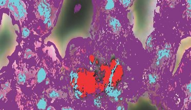 optical hyperspectral image overlaid on an enhanced darkfield image
