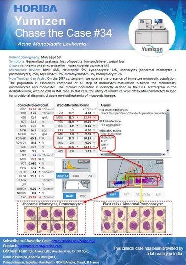 HORIBA Chase the Case #34 - Acute Monoblastic Leukemia