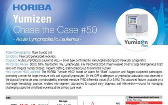 Acute Lymphoblastic Leukemia - Hematology Clinical Case "Chase the Case" #50