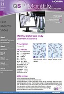HORIBA Medical QSP Newsletter #21 - Rouleaux pattern formation of red blood cells