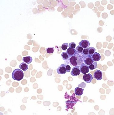 Erythroblastic_island