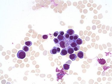 Erythroblastic_island