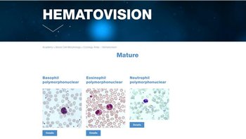 Hematovision