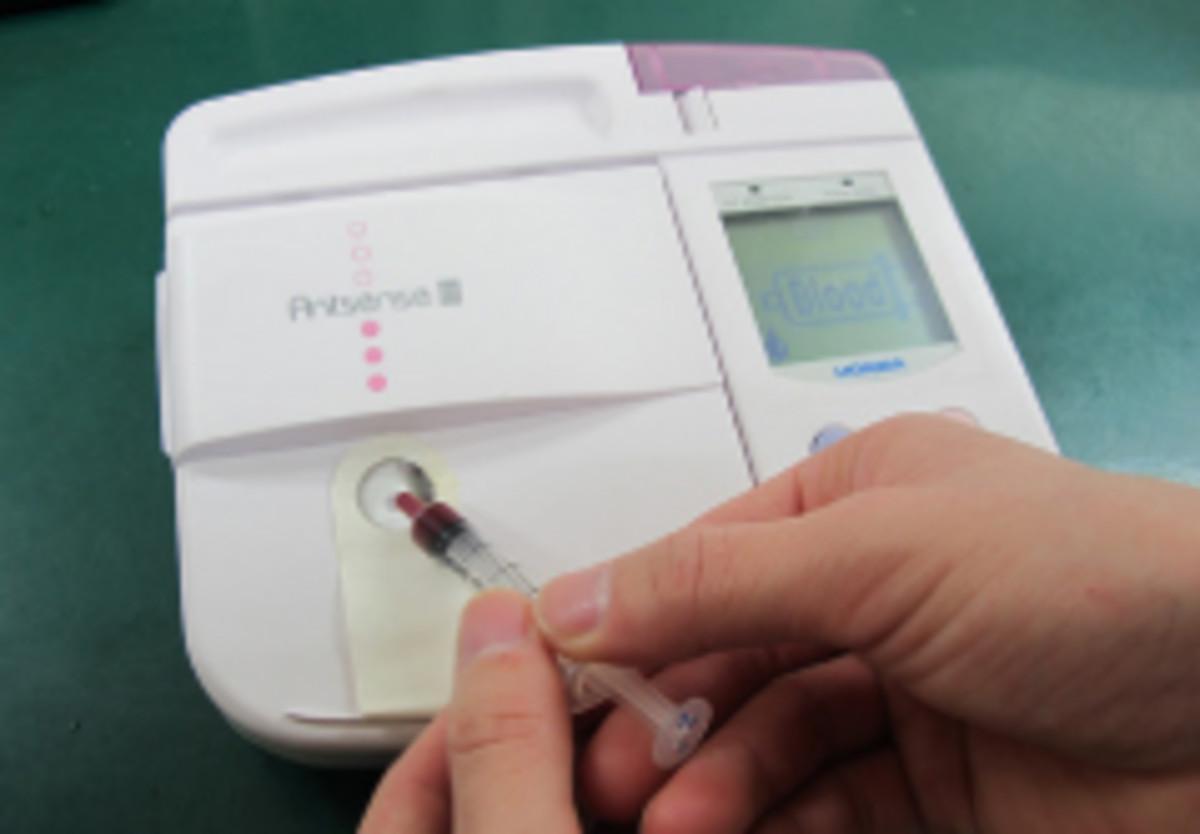 グルコース分析装置で血糖測定 グルコース分析装置で血糖測定