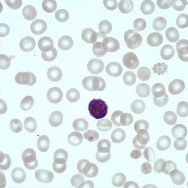 Lymphocyte