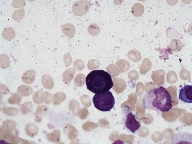 Mast_cell