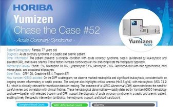 Acute Coronary Syndrome - Hematology Clinical Case "Chase the Case" #52