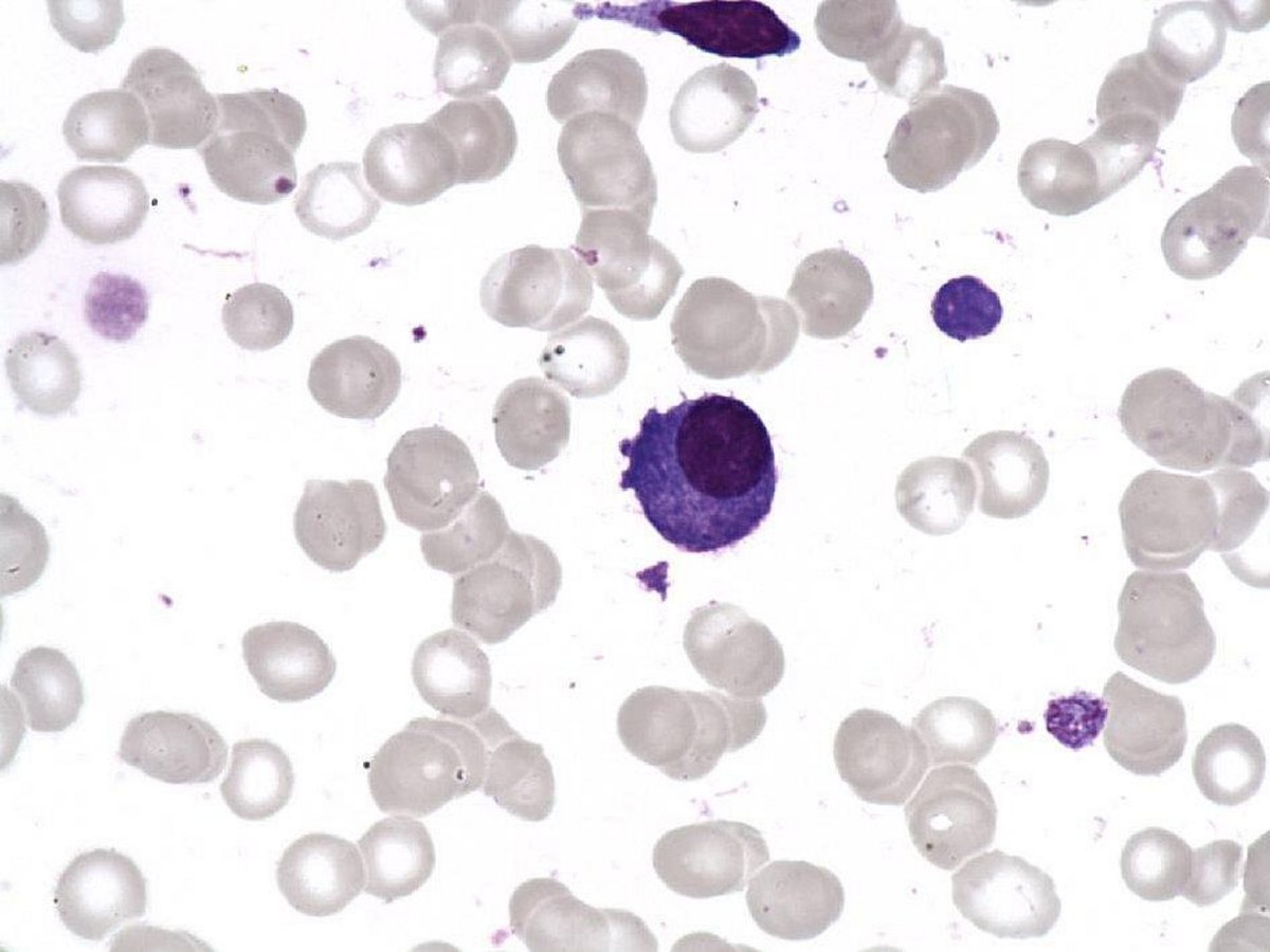 Plasmacell Plasmacell