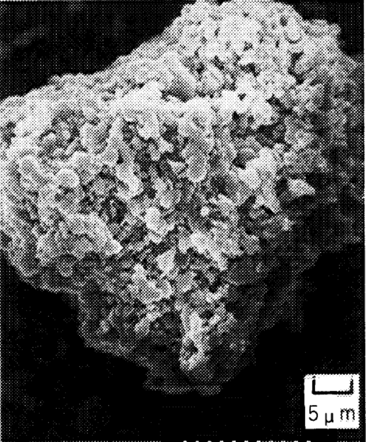 (B)個々の粒子が固まった粒子(アルミナ)