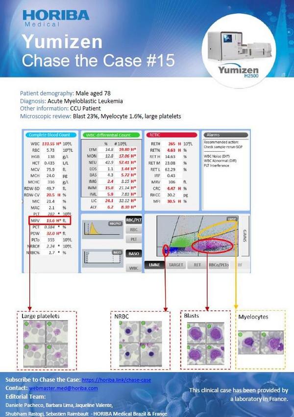 上品なブランド Leukemia - Medical HORIBA #26 Case the Chase Yumizen 小物