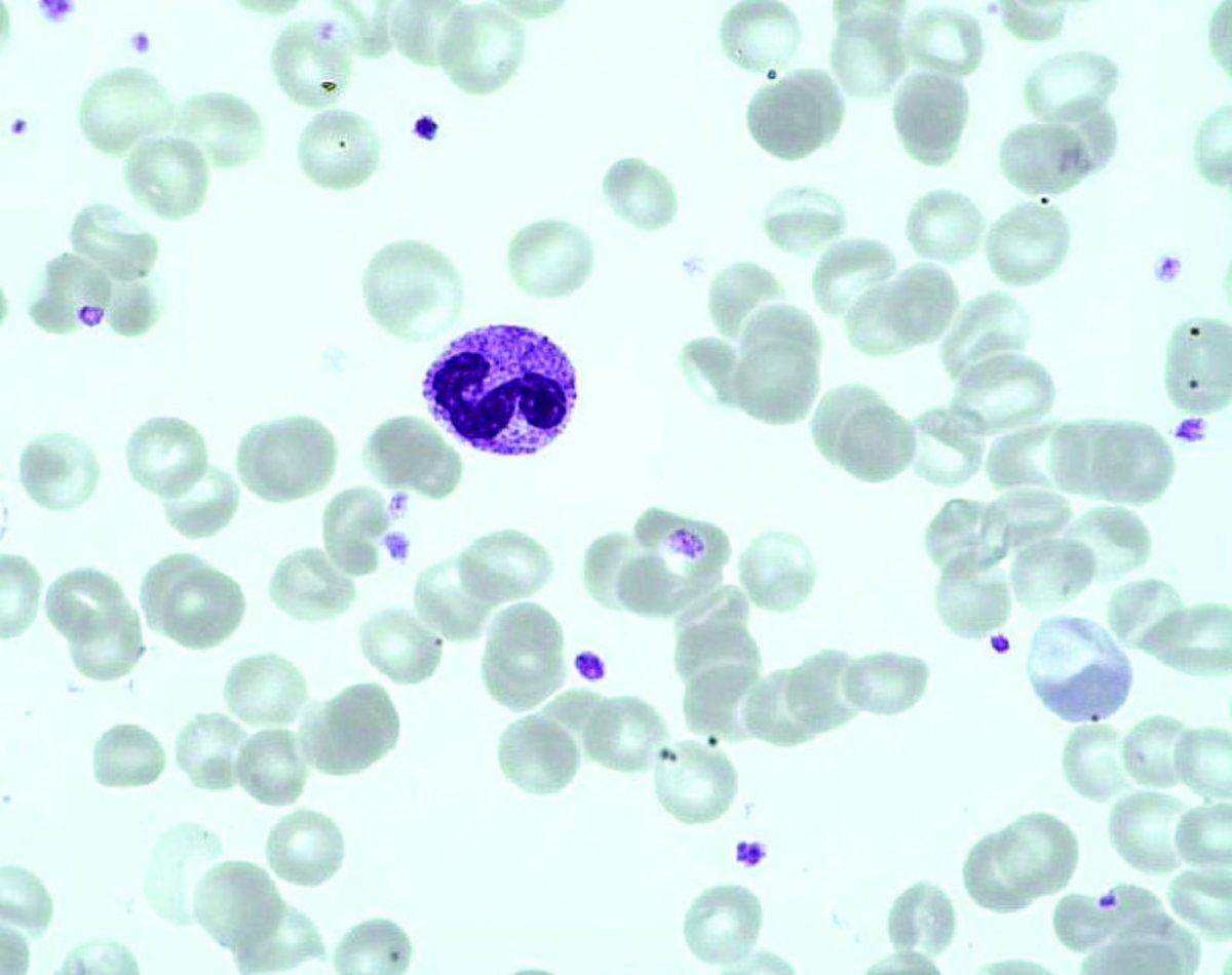 Neutrophil polymorphonuclear Neutrophil polymorphonuclear