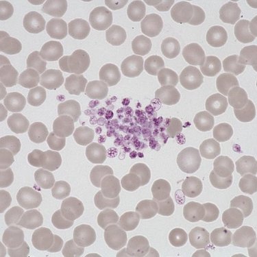 Platelet_aggregate