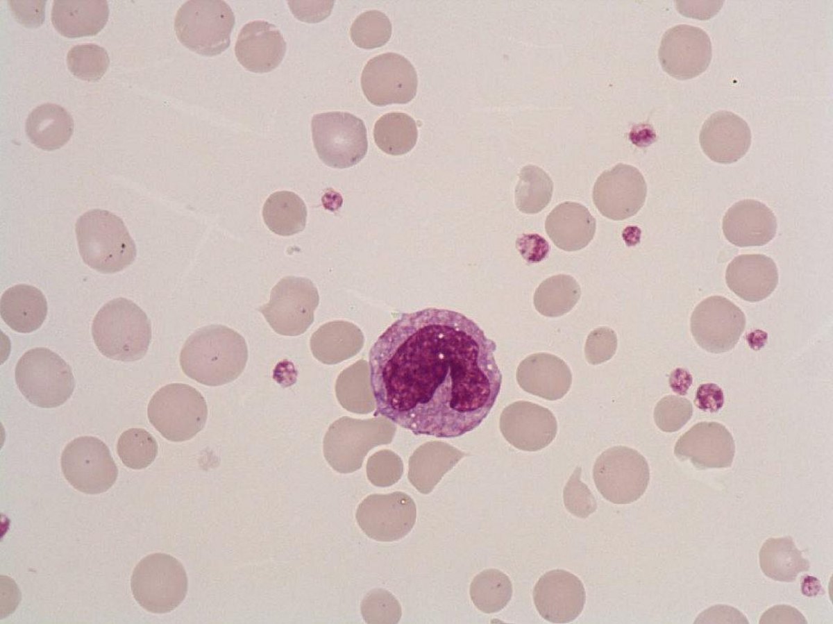 Monocyte