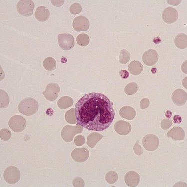 Monocyte