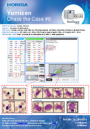 HORIBA Medical Chase the Case #6 - Secondary Myelodysplasia thumbnail