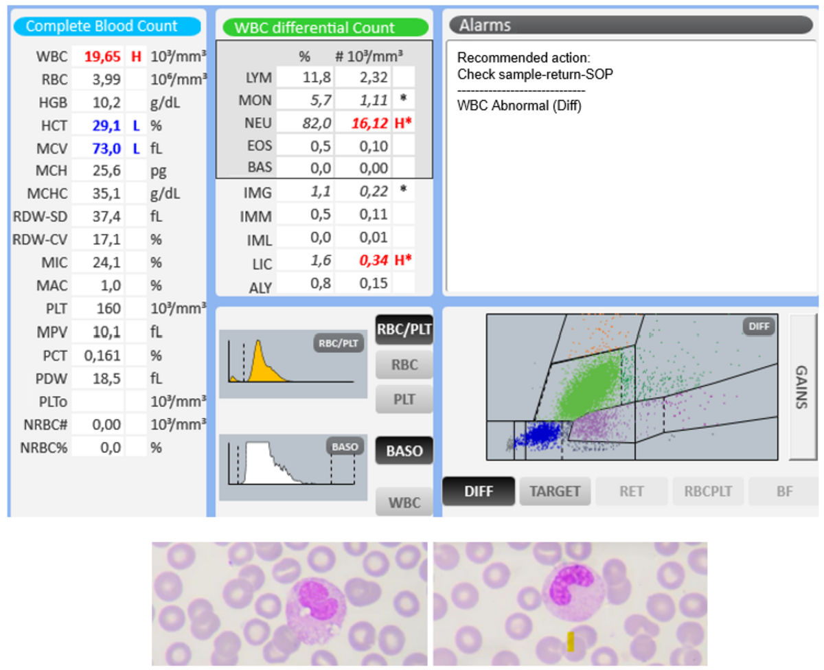 Chase the Case #53 Test Resut Screen